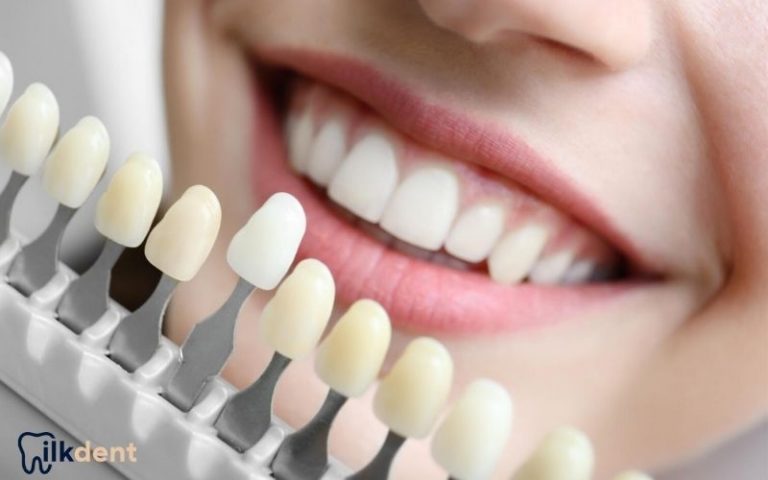 İstanbul Lamine Kaplama ile Diş Estetiğinizi Geliştirin